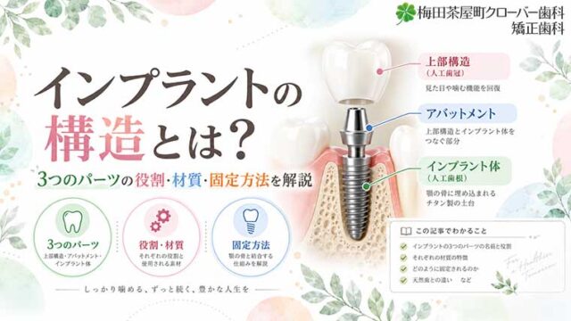 インプラントの構造とは？3つのパーツの役割・材質・固定方法を解説