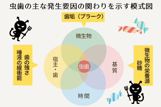 虫歯の主な発生要因