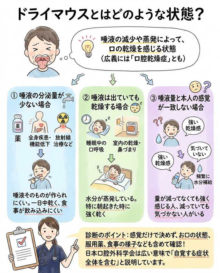 ドライマウスとはどのような状態？の図解
