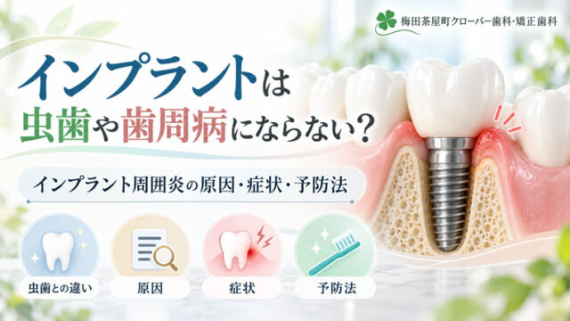 インプラントは虫歯や歯周病にならない？インプラント周囲炎の原因・症状・予防法