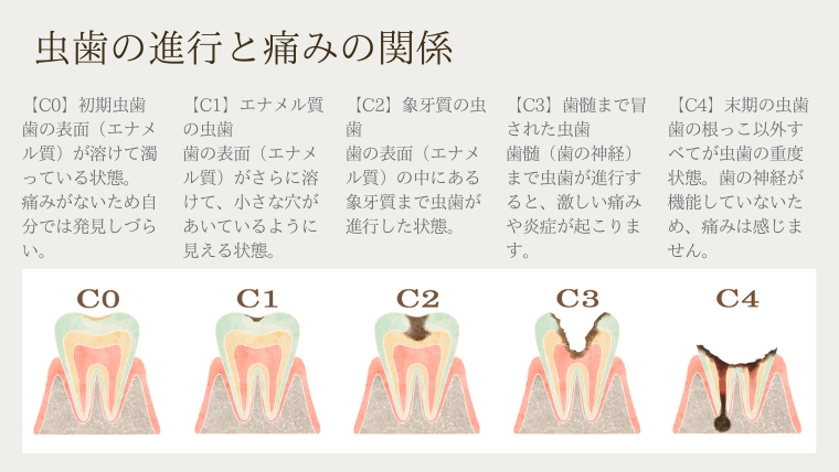 虫歯の進行と痛みの関係