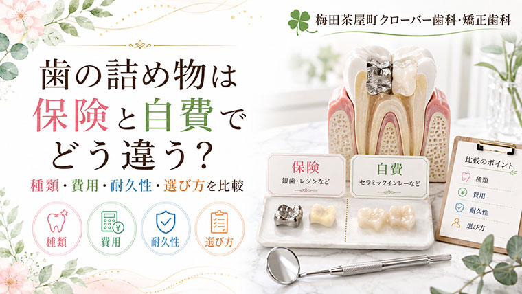 歯の詰め物は保険と自費でどう違う？種類・費用・耐久性・選び方を比較