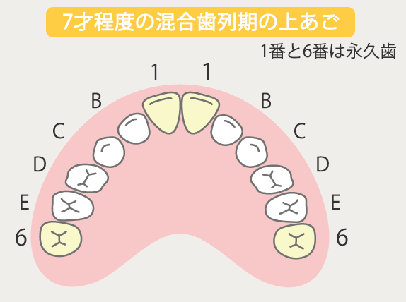 7歳程度の混合歯列期の上あご