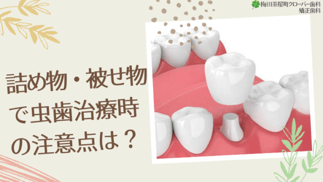 詰め物・被せ物で虫歯治療した歯への注意点はある？