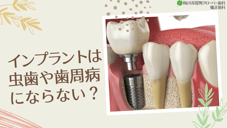 インプラントは虫歯や歯周病にならないの？