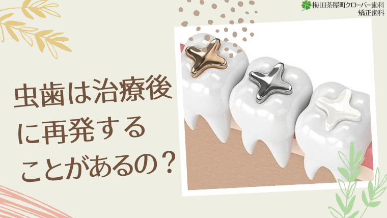 一度虫歯になると、治療してもまた虫歯になるの？
