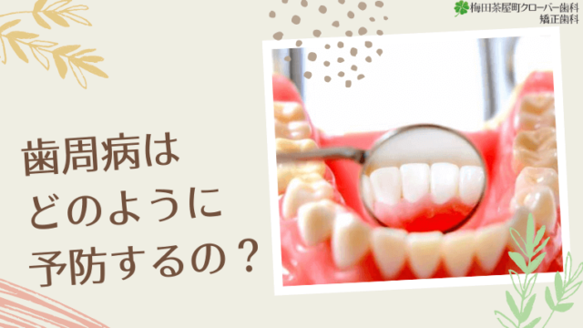 歯周病はどのように予防するの？