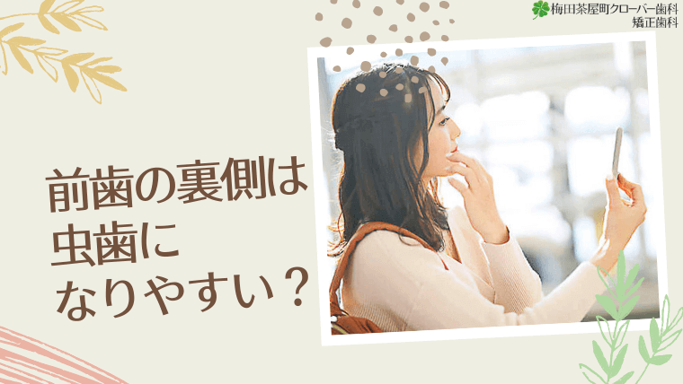 前歯の裏側は虫歯になりやすい？