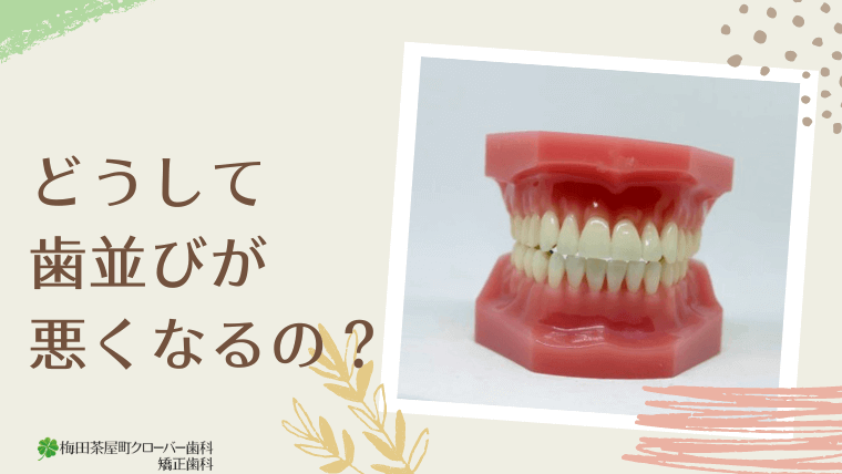 どうして歯並びが悪くなるの？