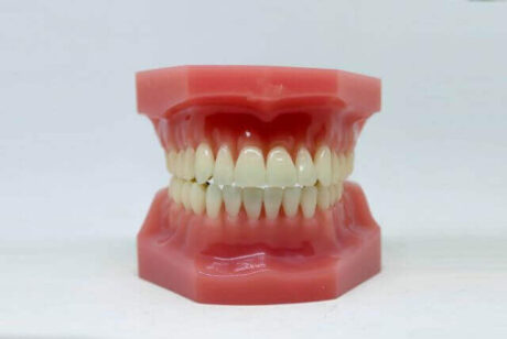 歯型模型
