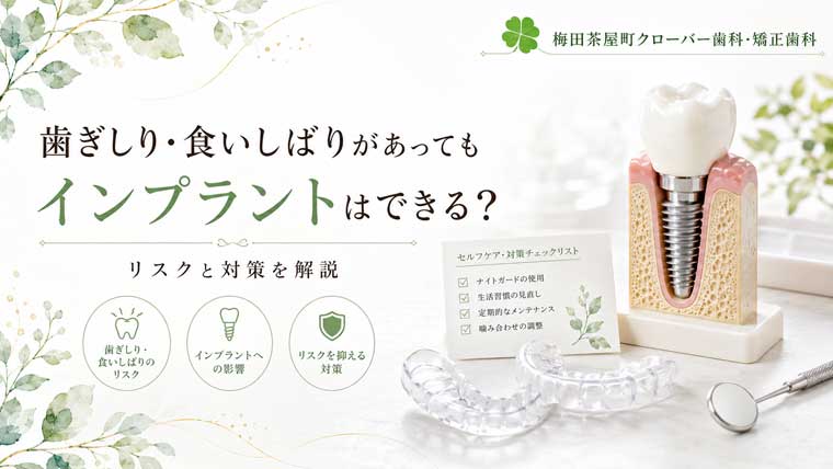 歯ぎしり・食いしばりがあってもインプラントはできる？リスクと対策を解説