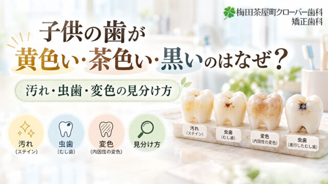 子供の歯が黄色い・茶色い・黒いのはなぜ？汚れ・虫歯・変色の見分け方