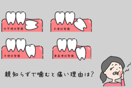 埋伏した親知らずの口腔外科手術