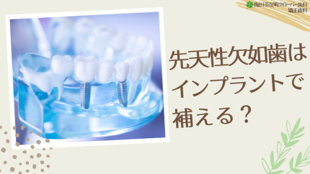 先天性欠如歯はインプラントで補える？