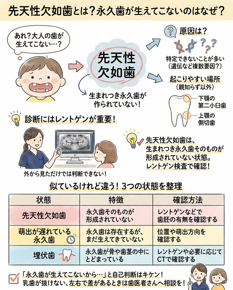 先天性欠如歯とは？永久歯が生えてこないのはなぜ？の図解