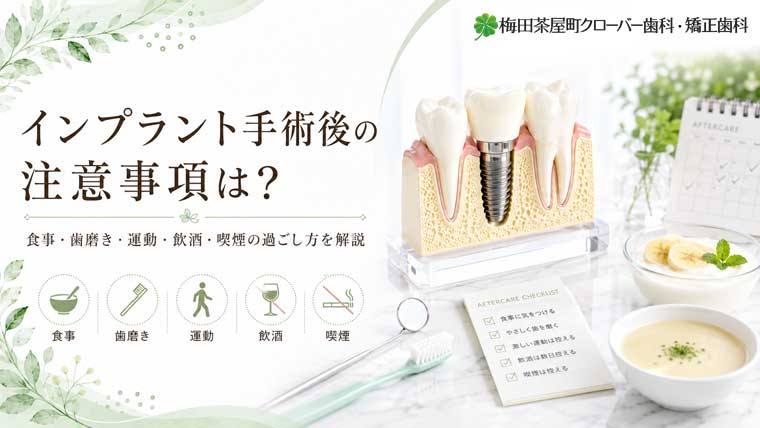インプラント手術後の注意事項は？食事・歯磨き・運動・飲酒・喫煙の過ごし方を解説
