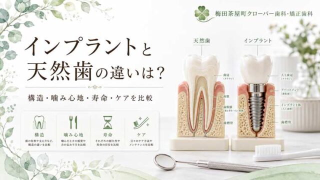 インプラントと天然歯の違いは？構造・噛み心地・寿命・ケアを比較