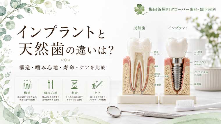 インプラントと天然歯の違いは？構造・噛み心地・寿命・ケアを比較