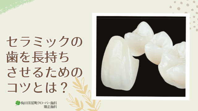 セラミックの歯を長持ちさせるコツとは？