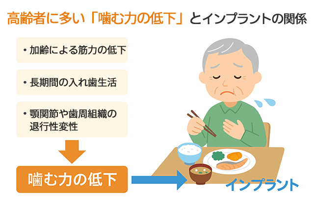 噛む力の低下