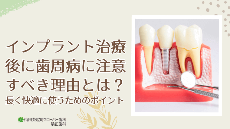 インプラント治療後に歯周病に注意すべき理由とは?