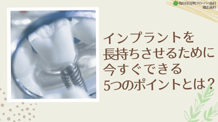 インプラントを長持ちさせるために今すぐできる5つのポイントとは?