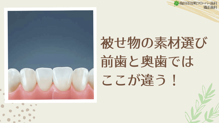 被せ物の素材選び 前歯と奥歯ではここが違う!