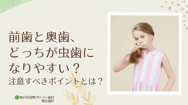 前歯と奥歯、どっちが虫歯になりやすい？