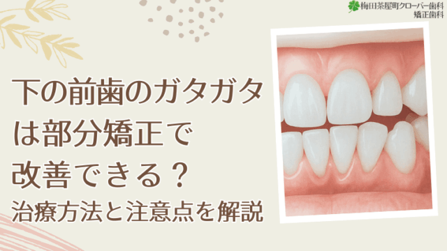 下の前歯のガタガタは部分矯正で改善できる？