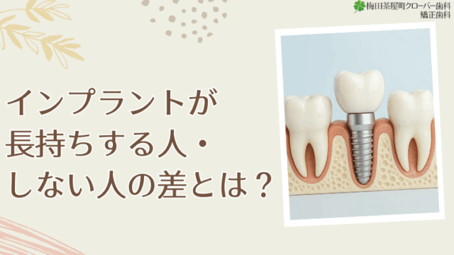 インプラントが長持ちする人・しない人の差とは？インプラントが長持ちする人・しない人の差とは？