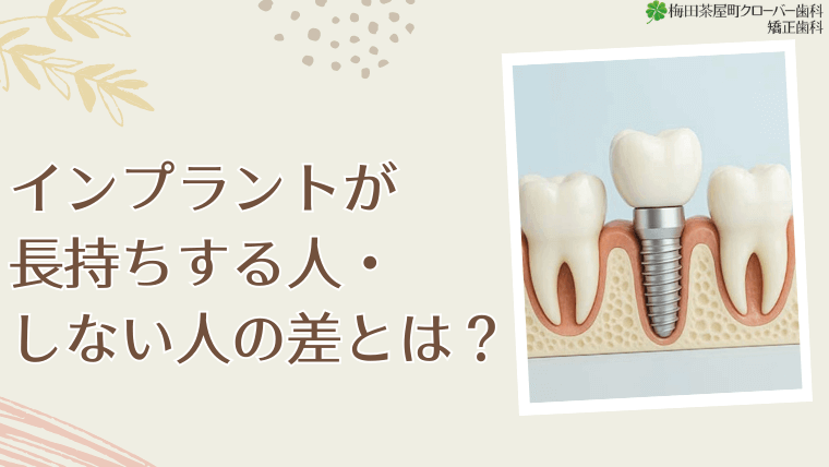 インプラントが長持ちする人・しない人の差とは？インプラントが長持ちする人・しない人の差とは？