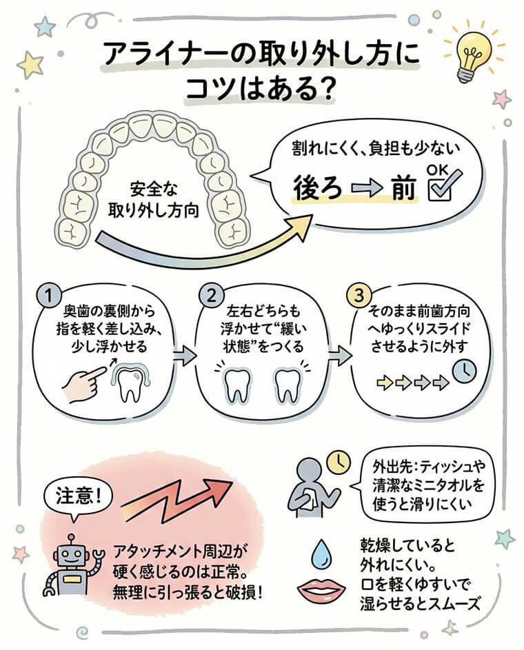 アライナーの取り外し方