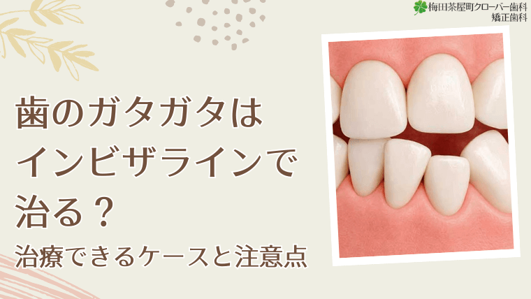 歯のガタガタはインビザラインで治る？治療できるケースと注意点