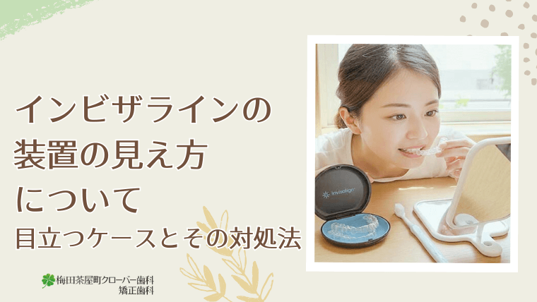インビザライン装置の見え方について｜目立つケースとその対処法
