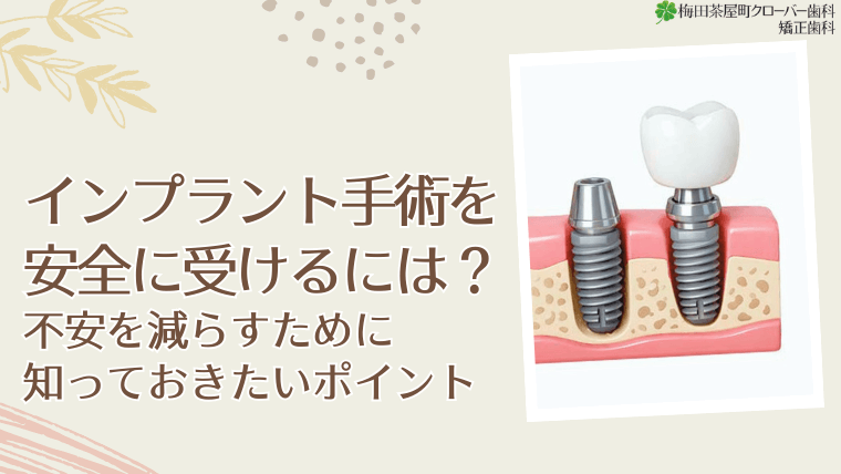 インプラント手術を安全に受けるには？不安を減らすために知っておきたいポイント