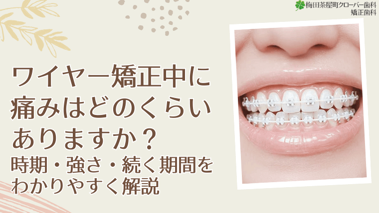 ワイヤー矯正中に痛みはどのくらいありますか？時期・強さ・続く期間をわかりやすく解説