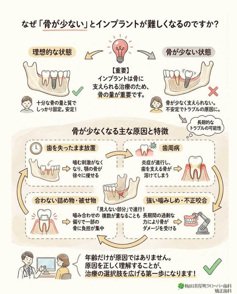 なぜ「骨が少ない」とインプラントが難しくなるのですか？