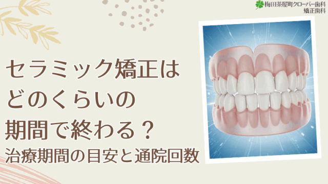 セラミック矯正はどのくらいの期間で終わる？治療期間の目安と通院回数