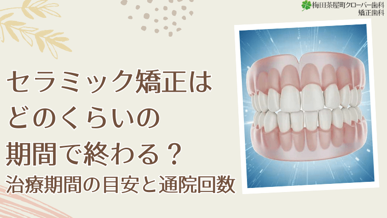 セラミック矯正はどのくらいの期間で終わる？治療期間の目安と通院回数