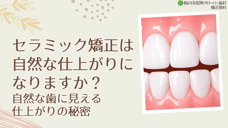 セラミック矯正は自然な仕上がりになりますか？自然な歯に見える仕上がりの秘密