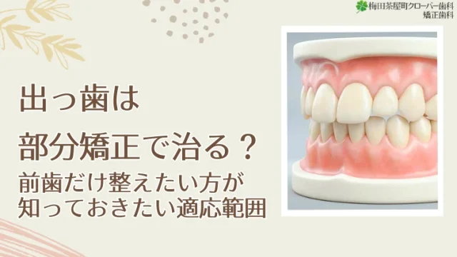 出っ歯は部分矯正で治る？前歯だけ整えたい方が知っておきたい適応範囲