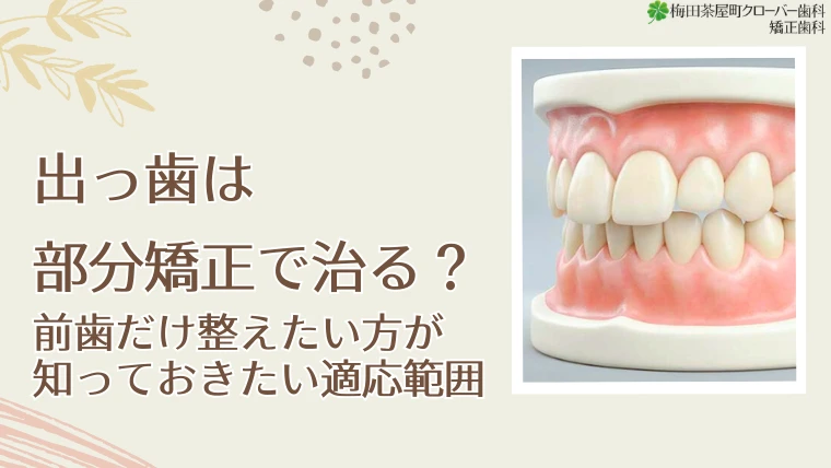 出っ歯は部分矯正で治る？前歯だけ整えたい方が知っておきたい適応範囲