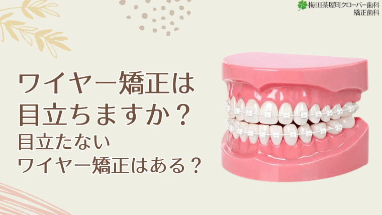 ワイヤー矯正は目立ちますか？目立たないワイヤー矯正はある？
