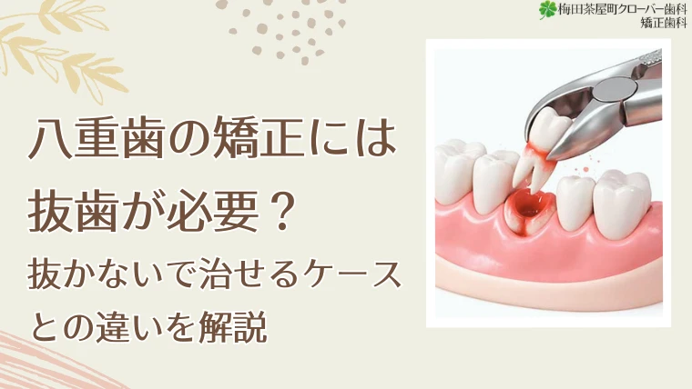 八重歯の矯正には抜歯が必要？抜かないで治せるケースとの違いを解説