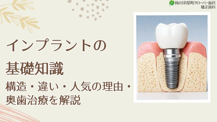 インプラントの基礎知識｜構造・違い・人気の理由・奥歯治療を解説