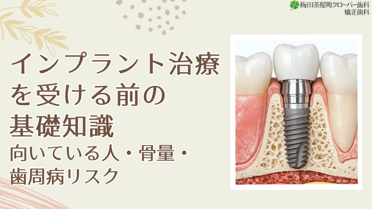インプラント治療を受ける前の基礎知識｜向いている人・骨量・歯周病リスク