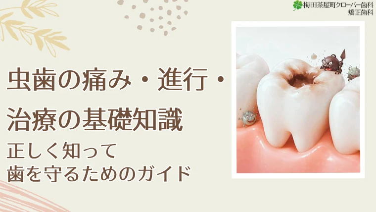 虫歯の痛み・進行・治療の基礎知識　正しく知って歯を守るためのガイド