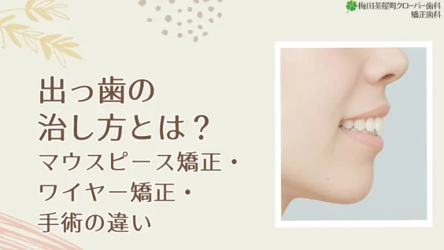 出っ歯の治し方とは？マウスピース矯正・ワイヤー矯正・手術の違い
