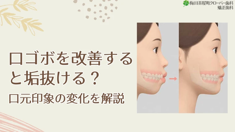 口ゴボを改善すると垢抜ける？口元印象の変化を解説