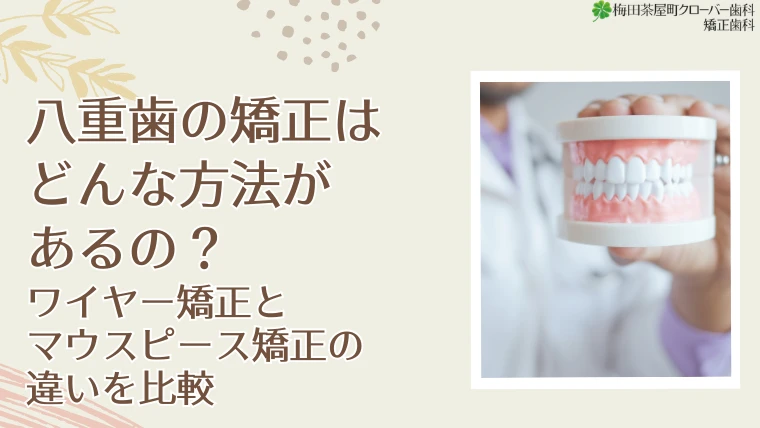 八重歯の矯正はどんな方法があるの？ワイヤー矯正とマウスピース矯正の違いを比較